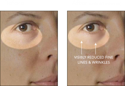 Naturopathica Natural Face Lift